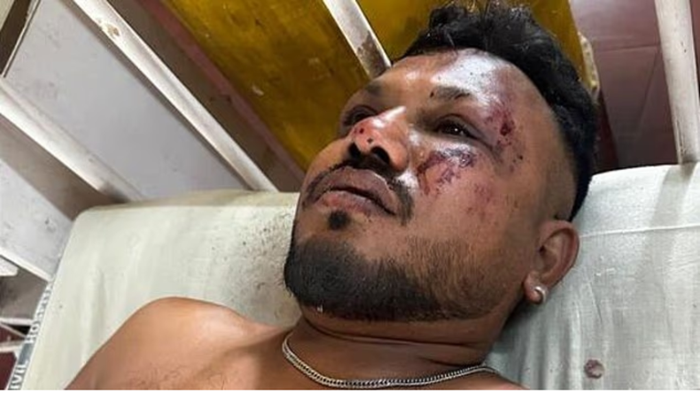 El sobreviviente sufrió heridas en el rostro