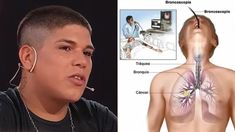 Thiago Medina deberá exponerse a una fibrobroncoscopia.