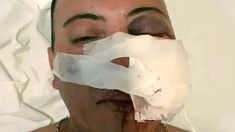 Arballo sufrió la represión policial. Arballo sufrió la represión policial.