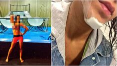 Mirá cómo le quedó la cara a Celeste Muriega tras accidentarse en el primer ensayo del Aquadance Mirá cómo le quedó la cara a Celeste Muriega tras accidentarse en el primer ensayo del Aquadance