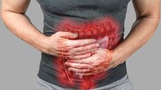 El cáncer de colon es un tipo de cáncer que se forma en los tejidos del colon. El cáncer de colon es un tipo de cáncer que se forma en los tejidos del colon.