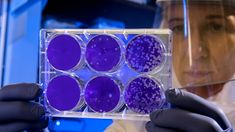 Investigadores de la UBA trabajan en la creación de órganos bioartificales para trasplantes. Investigadores de la UBA trabajan en la creación de órganos bioartificales para trasplantes.