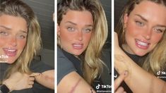 La Tiktoker relató a sus seguidores cómo sufrió las consecuencias de borrar sus tatuajes. La Tiktoker relató a sus seguidores cómo sufrió las consecuencias de borrar sus tatuajes.