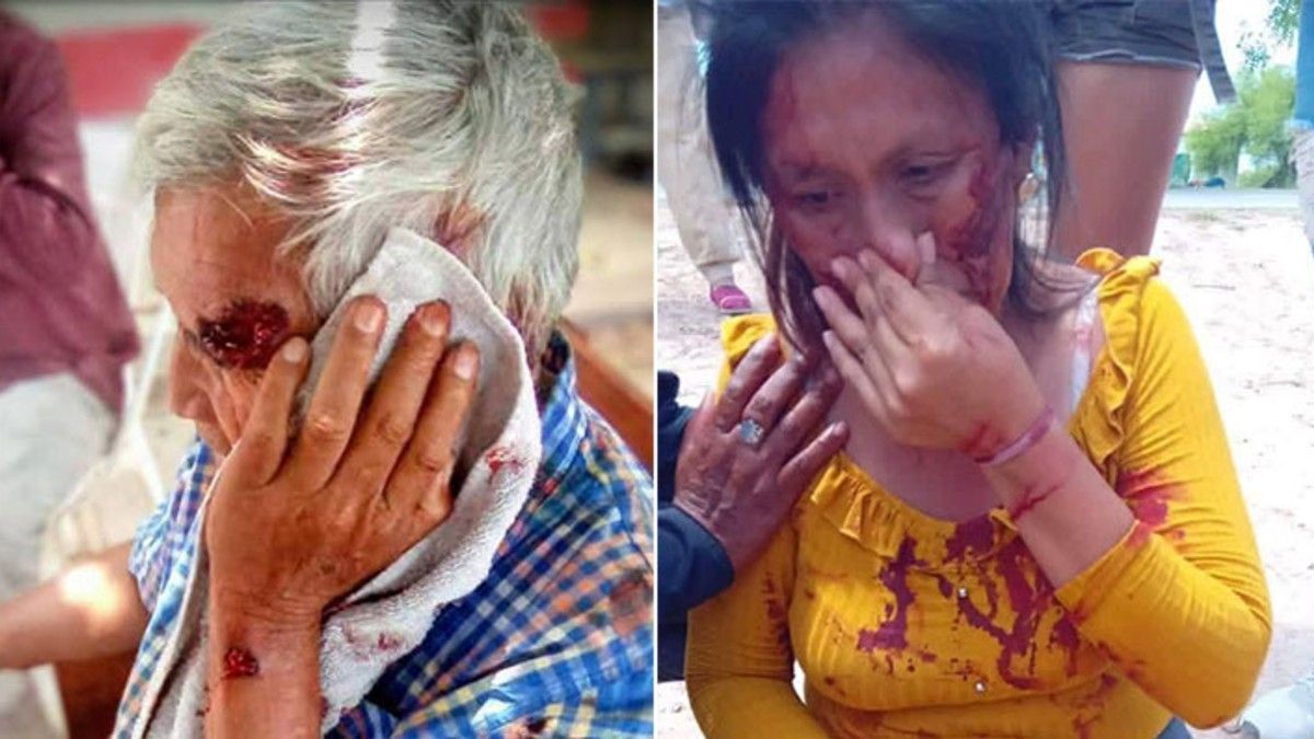 Video: violentos enfrentamientos en Chaco entre la policía y manifestantes que pedían pensiones de discapacidad