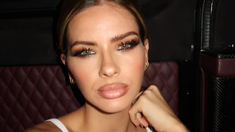 La mediática mostró una foto impactante de una quemadura que sufrió en el rodaje. La mediática mostró una foto impactante de una quemadura que sufrió en el rodaje.