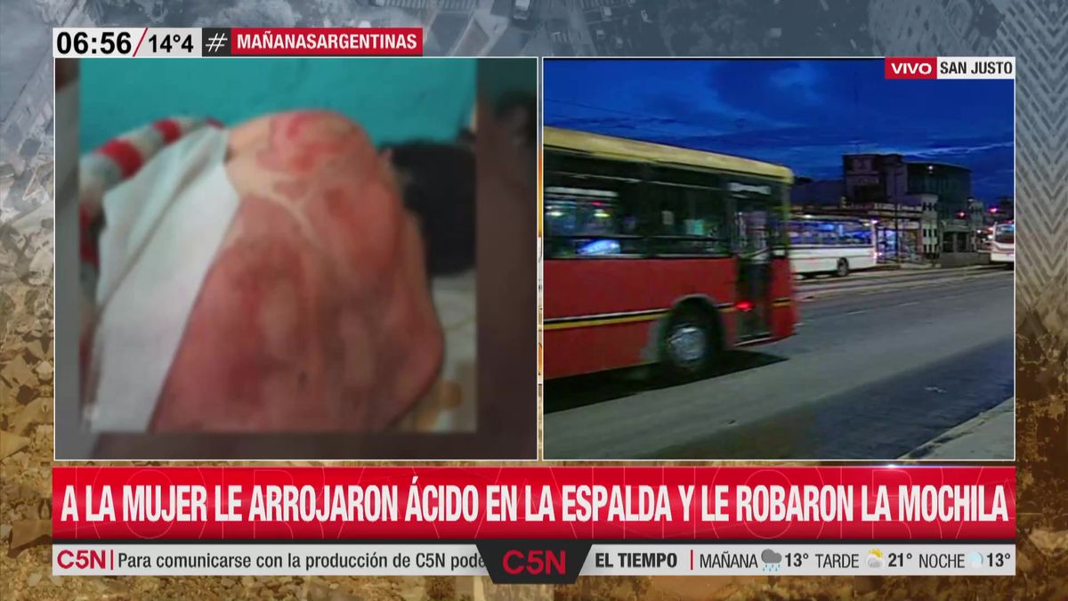 Esperaba el colectivo y le tiraron ácido para robarle la mochila