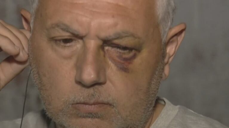 El veterinario Claudio Bulgarella fue salvajemente golpeado en 2021 en Morón tras la muerte de un caniche que tenía una enfermedad previa que complicó una cirugía.