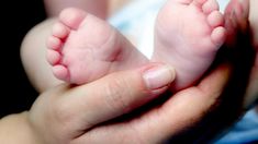 Extraño caso en una bebe recién nacida en México. Extraño caso en una bebe recién nacida en México.