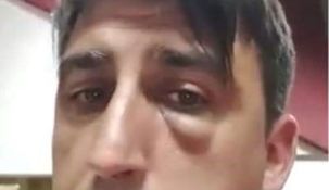 El entrenador argentino Andrés Maringueli fue expulsado luego de la agresión.