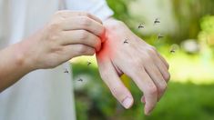 Conocé los tips para que no haya mosquitos en tu casa
