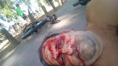 Carlos Desirello tirado en el piso mientras esperaba la ambulancia tras ser atropellado. Carlos Desirello tirado en el piso mientras esperaba la ambulancia tras ser atropellado.