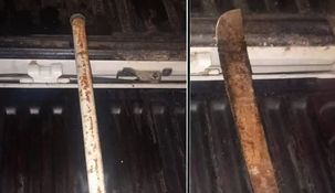 un hombre fue atacado por un vecino con un machete y esta en terapia intensiva un hombre fue atacado por un vecino con un machete y esta en terapia intensiva