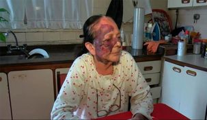 Atacaron violentamente a la mujer mientras dormía.