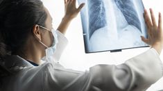 Presentan un tratamiento para un tipo de cáncer de pulmón en Argentina. Presentan un tratamiento para un tipo de cáncer de pulmón en Argentina.