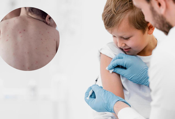 C5N | Brote sarampión, vacuna