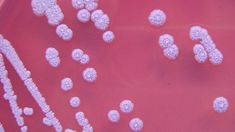 Alarma en EEUU por la detección de la bacteria que produce la memelioidosis humana.