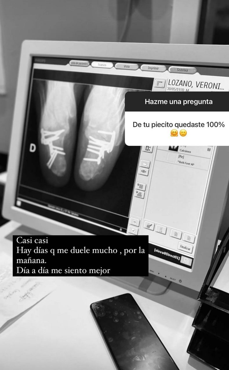 La radiografía que compartió Verónica Lozano.