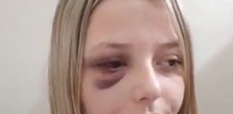 Así quedó el rostro de la joven luego de la fuerte agresión recibida