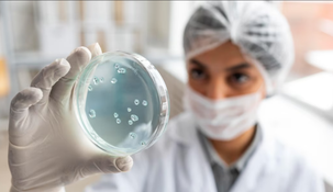 La OMS alerta por el virus Maburgo.