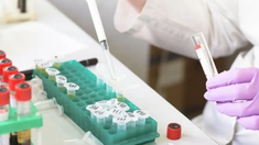 No hay insumos o no quieren entregarlos, advierten los bioquímicos.