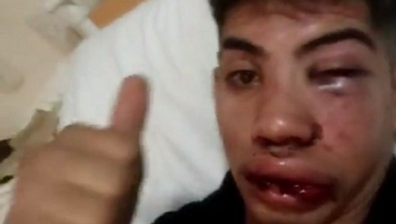 Nazareno Urraco, la v&iacute;ctima de la golpiza feroz.
