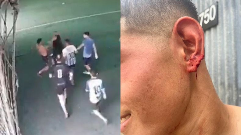 Chipi Gandín se peleó con un rival en la cancha y le mordió la oreja