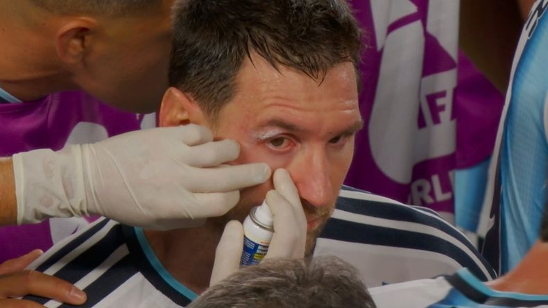 Messi sugrió un golpe y quedó ensangrentado.