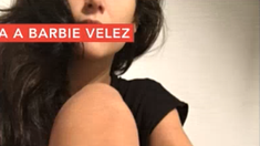 Las nuevas fotos de la pericia médica de Barbie Vélez advierten violencia crónica Las nuevas fotos de la pericia médica de Barbie Vélez advierten violencia crónica