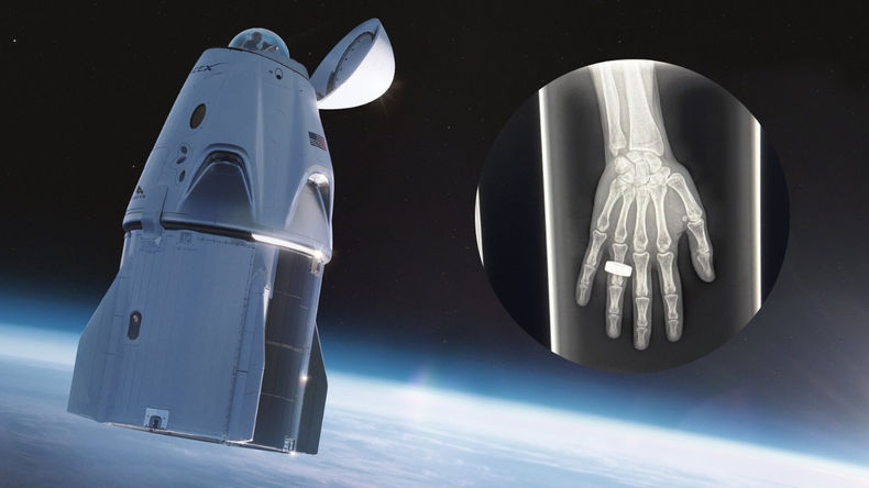 Este tipo de radiografías permitirá chequear la salud de los astronautas en misiones largas.