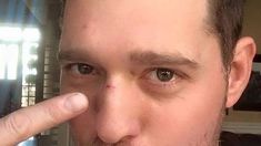 ¿Qué le pasó a Michael Bublé?: apareció lastimado en las redes sociales ¿Qué le pasó a Michael Bublé?: apareció lastimado en las redes sociales