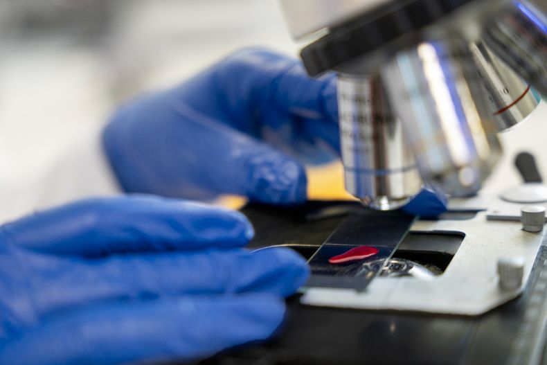Desde el Conicet investigan los microARN para la detección temprana del cáncer de mama.