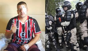 Navarro perdió la visión de un ojo tras la represión de Martínez.