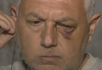 C5N | Claudio Bulgarella veterinario golpeado 2021 Morón