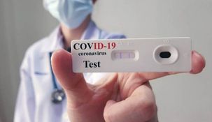 Las farmacias deberán registrar a los compradores e informar los resultados.