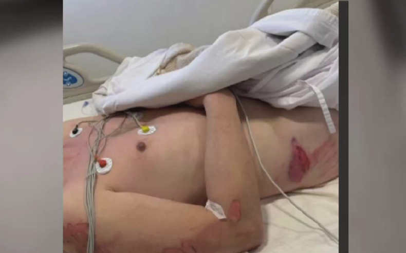 El hombre víctima de la viuda negra en Mar del Plata. El hombre víctima de la viuda negra en Mar del Plata.