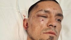 Dramático relato del profesor de kickboxing agredido por la espalda: Tengo la cara quebrada en tres partes
