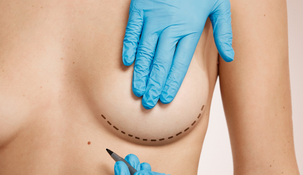 Las cirugías plásticas son impulsadas por la búsqueda de un ideal de belleza casi inalcanzable. Las cirugías plásticas son impulsadas por la búsqueda de un ideal de belleza casi inalcanzable.