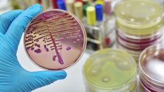 alerta en europa por una nueva cepa de gonorrea resistente a medicamentos