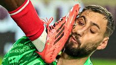 La escalofriante imagen del momento exacto del planchazo en la cara a Donnarumma. La escalofriante imagen del momento exacto del planchazo en la cara a Donnarumma.
