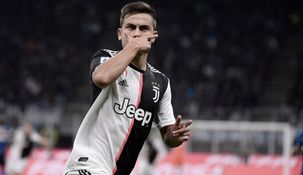 El delantero de la Juventus se hizo un radical cambio de look.